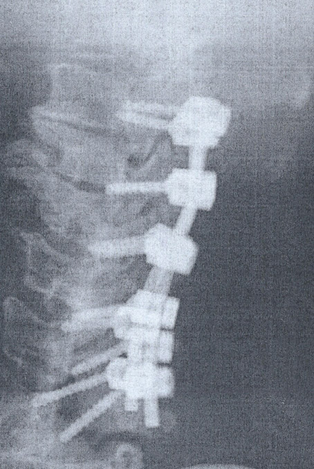 Cranky Crank’s Damage Repair