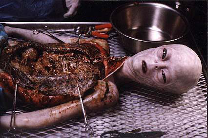 Michael Jackson’s Autopsy Secrets Revealed!